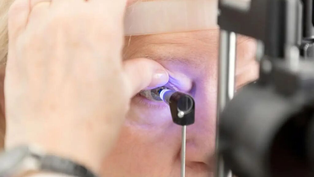 Glaucoma atinge milhões e reforça alerta para diagnóstico precoce (Foto: CBO/Divulgação)