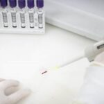 São Paulo investiga caso suspeito de Ebola e mantém vigilância em saúde no estado
